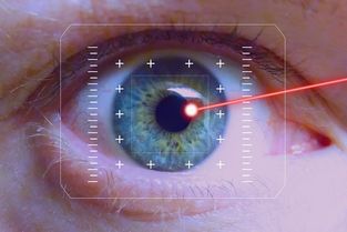  激光矫正手术对近视眼的疗效如何？